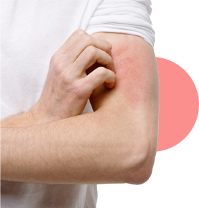 tratamientos_0010_dermatitis